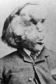 Joseph Merrick en The Curse of the Elephant Man
