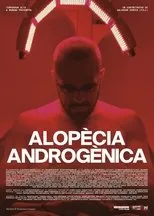 Póster de Alopècia androgènica