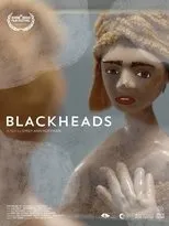 Póster de Blackheads